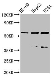 Western Blot Positive WB detected in: HL-60 whole cell lysate, HepG2 whole cell lysate, U251 whole cell lysate All lanes: ENTPD1 antibody at 2.6µg/ml Secondary Goat polyclonal to rabbit IgG at 1/50000 dilution Predicted band size: 58, 59, 35, 43,...