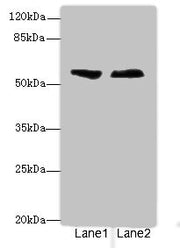 Western blot All lanes: ENTPD2antibody at 3.6ug/ml Lane 1: Human placenta tissue Lane 2: U87 whole cell lysate Secondary Goat polyclonal to rabbit IgG at 1/10000 dilution Predicted band size: 54, 52, 49 kDa Observed band size: 54 kDa