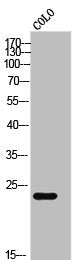Western Blot analysis of COLO cells using CaBP7 Polyclonal Antibody