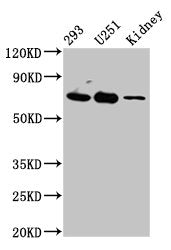 Western Blot Positive WB detected in: 293 whole cell lysate, U251 whole cell lysate, Rat kidney tissue All lanes: EOMES antibody at 4.5µg/ml Secondary Goat polyclonal to rabbit IgG at 1/50000 dilution Predicted band size: 73, 48, 46, 75 kDa Observ...