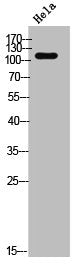 Western Blot analysis of Hela cells using GPR113 Polyclonal Antibody