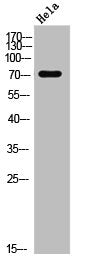 Western Blot analysis of Jurkat cells using DDX3 Polyclonal Antibody