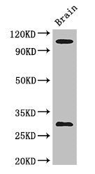 Western Blot Positive WB detected in: Mouse brain tissue All lanes: EPHA1 antibody at 3ug/ml Secondary Goat polyclonal to rabbit IgG at 1/50000 dilution Predicted band size: 109, 53, 52 kDa Observed band size: 109, 30 kDa