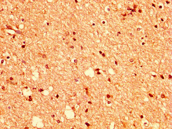 IHC image of CSB-PA007722LA01HU diluted at 1:400 and staining in paraffin-embedded human brain tissue performed on a Leica BondTM system. After dewaxing and hydration, antigen retrieval was mediated by high pressure in a citrate buffer (pH 6.0). S...