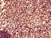 Immunohistochemistry of paraffin-embedded human spleen tissue using CSB-PA007724LA01HU at dilution of 1:100