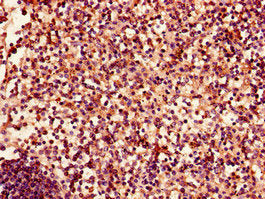 Immunohistochemistry of paraffin-embedded human spleen tissue using CSB-PA007724LA01HU at dilution of 1:100