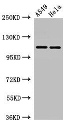 Western Blot Positive WB detected in: A549 whole cell lysate, Hela whole cell lysate All lanes: EPHA5 antibody at 3µg/ml Secondary Goat polyclonal to rabbit IgG at 1/50000 dilution Predicted band size: 115, 113, 108 kDa Observed band size: 115 kDa