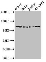 Western Blot Positive WB detected in: MCF-7 whole cell lysate, Hela whole cell lysate, Jurkat whole cell lysate, NIH/3T3 whole cell lysate All lanes: EPHB3 antibody at 2.7ug/ml Secondary Goat polyclonal to rabbit IgG at 1/50000 dilution Predicted...