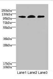 Western blot All lanes: EPHB4 antibody at 2.71ug/ml Lane 1: A549 whole cell lysate Lane 2: 293T whole cell lysate Lane 3: Hela whole cell lysate Secondary Goat polyclonal to rabbit IgG at 1/10000 dilution Predicted band size: 109, 56, 34, 46 kDa O...