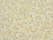 Immunohistochemistry of paraffin-embedded human liver tissue using CSB-PA007732ESR2HU at dilution of 1:100