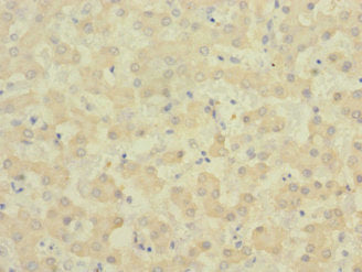 Immunohistochemistry of paraffin-embedded human liver tissue using CSB-PA007732ESR2HU at dilution of 1:100