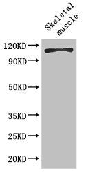 Western Blot Positive WB detected in: Mouse skeletal muscle tissue All lanes: EPHB6 antibody at 2ug/ml Secondary Goat polyclonal to rabbit IgG at 1/50000 dilution Predicted band size: 111, 82, 58 kDa Observed band size: 111 kDa