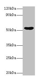 Western blot All lanes: EPHX1 antibody at 2µg/ml + Hela whole cell lysate Secondary Goat polyclonal to rabbit IgG at 1/10000 dilution Predicted band size: 53 kDa Observed band size: 53 kDa