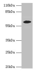 Western blot All lanes: EPHX2 antibody at 2µg/ml + MCF-7 whole cell lysate Secondary Goat polyclonal to rabbit IgG at 1/10000 dilution Predicted band size: 63, 58, 56 kDa Observed band size: 58 kDa