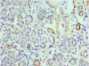 Immunohistochemistry of paraffin-embedded human salivary gland tissue using CSB-PA007738ESR1HU at dilution of 1:100