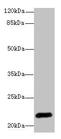 Western blot All lanes: EPO antibody at 3µg/ml + HepG2 whole cell lysate Secondary Goat polyclonal to rabbit IgG at 1/10000 dilution Predicted band size: 22 kDa Observed band size: 22 kDa