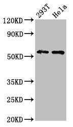 Western Blot Positive WB detected in: 293T whole cell lysate, Hela whole cell lysate All lanes: EPOR antibody at 4.3ug/ml Secondary Goat polyclonal to rabbit IgG at 1/50000 dilution Predicted band size: 56, 27, 36 kDa Observed band size: 56 kDa