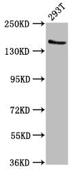 Western Blot Positive WB detected in: 293T whole cell lysate All lanes: EPRS antibody at 7.4ug/ml Secondary Goat polyclonal to rabbit IgG at 1/50000 dilution Predicted band size: 171 kDa Observed band size: 171 kDa