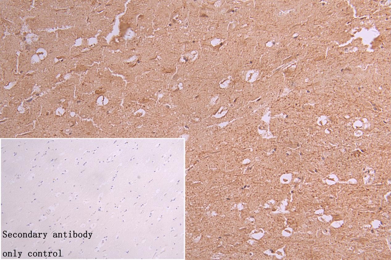 IHC image of CSB-PA007756LA01HU diluted at 1:100 and staining in paraffin-embedded human brain tissue performed on a Leica BondTM system. After dewaxing and hydration, antigen retrieval was mediated by high pressure in a citrate buffer (pH 6.0). S...
