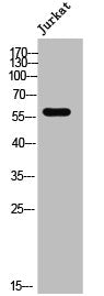 Western Blot analysis of Jurkat cells using ZNF596 Polyclonal Antibody
