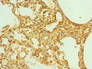 Immunohistochemistry of paraffin-embedded human lung tissue using CSB-PA007765ESR1HU at dilution of 1:100
