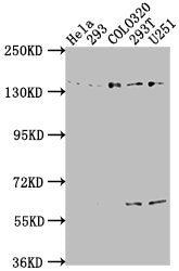 Western Blot Positive WB detected in: Hela whole cell lysate, 293 whole cell lysate, COLO320 whole cell lysate, 293T whole cell lysate, U251 whole cell lysate All lanes: ERC1 antibody at 1:2000 Secondary Goat polyclonal to rabbit IgG at 1/50000 di...