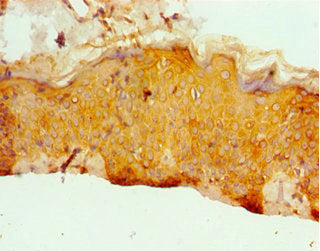 Immunohistochemistry of paraffin-embedded human skin tissue using CSB-PA007770ESR1HU at dilution of 1:100