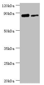 Western blot All lanes: TFIIH basal transcription factor complex helicase XPD subunit antibody at 2ug/ml Lane 1: 293T whole cell lysate Lane 2: K562 whole cell lysate Secondary Goat polyclonal to rabbit IgG at 1/10000 dilution Predicted band size:...