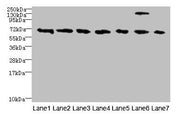 Western blot All lanes: TRPM2 antibody at 3µg/ml Lane 1: HepG2 whole cell lysate Lane 2: Mouse brain tissue Lane 3: A549 whole cell lysate Lane 4: K562 whole cell lysate Lane 5: Mouse kidney tissue Lane 6: Human placenta tissue Lane 7: Mouse splee...