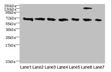 Western blot All lanes: TRPM2 antibody at 3µg/ml Lane 1: HepG2 whole cell lysate Lane 2: Mouse brain tissue Lane 3: A549 whole cell lysate Lane 4: K562 whole cell lysate Lane 5: Mouse kidney tissue Lane 6: Human placenta tissue Lane 7: Mouse splee...