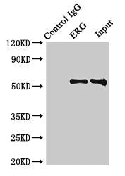 Immunoprecipitating ERG in Rat heart tissue Lane 1: Rabbit control IgG (1µg) instead of CSB-PA007781HA01HU in Rat heart tissue. For western blotting, a HRP-conjugated Protein G antibody was used as the secondary antibody (1/2000) Lane 2: CSB-PA007...