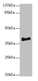 Western blot All lanes: ERLIN1 antibody at 4µg/ml + Mouse brain tissue Secondary Goat polyclonal to rabbit IgG at 1/10000 dilution Predicted band size: 39 kDa Observed band size: 39 kDa