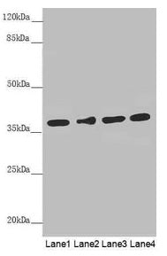 Western blot All lanes: ERLIN2 antibody at 3.1µg/ml Lane 1: 293T whole cell lysate Lane 2: HepG2 whole cell lysate Lane 3: U251 whole cell lysate Lane 4: Hela whole cell lysate Secondary Goat polyclonal to rabbit IgG at 1/10000 dilution Predicted...