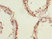 Immunohistochemistry of paraffin-embedded human testis tissue using CSB-PA007794ESR1HU at dilution of 1:100