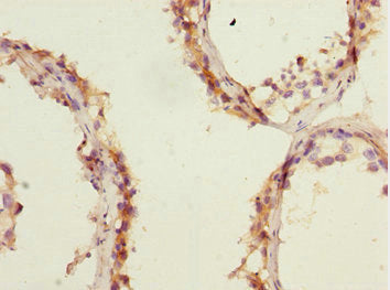 Immunohistochemistry of paraffin-embedded human testis tissue using CSB-PA007794ESR1HU at dilution of 1:100