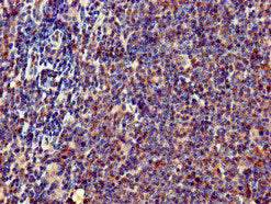 Immunohistochemistry of paraffin-embedded human lymph node tissue using CSB-PA007795LA01HU at dilution of 1:100