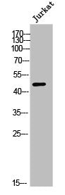 Western Blot analysis of Jurkat cells using DHODH Polyclonal Antibody