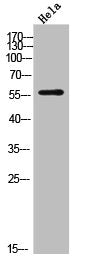 Western Blot analysis of HeLa cells using Dyskerin Polyclonal Antibody