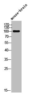 Western Blot analysis of Mouse-Brain cells using Phospho-Dynamin I (S778) Polyclonal Antibody