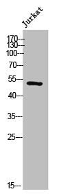 Western Blot analysis of Jurkat cells using Dok-1 Polyclonal Antibody