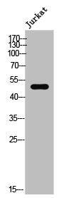 Western Blot analysis of JK cells using Phospho-CRMP-2 (T509) Polyclonal Antibody