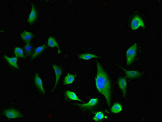 Immunofluorescent analysis of U251 cells using CSB-PA007823LA01HU at dilution of 1:100 and Alexa Fluor 488-congugated AffiniPure Goat Anti-Rabbit IgG(H+L)