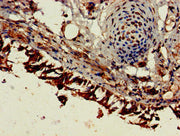 Immunohistochemistry of paraffin-embedded human lung tissue using CSB-PA007825HA01HU at dilution of 1:100