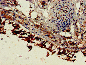 Immunohistochemistry of paraffin-embedded human lung tissue using CSB-PA007825HA01HU at dilution of 1:100