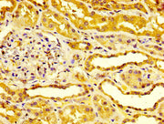 IHC image of CSB-PA007825LA01HU diluted at 1:400 and staining in paraffin-embedded human kidney tissue performed on a Leica BondTM system. After dewaxing and hydration, antigen retrieval was mediated by high pressure in a citrate buffer (pH 6.0)....