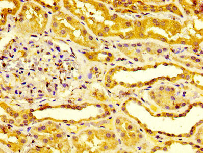 IHC image of CSB-PA007825LA01HU diluted at 1:400 and staining in paraffin-embedded human kidney tissue performed on a Leica BondTM system. After dewaxing and hydration, antigen retrieval was mediated by high pressure in a citrate buffer (pH 6.0)....