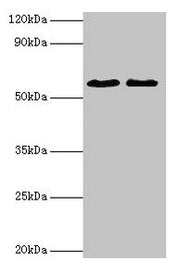 Western blot All lanes: ESR2 antibody at 2µg/ml Lane 1: Mouse brain tissue Lane 2: PC-3 whole cell lysate Secondary Goat polyclonal to rabbit IgG at 1/10000 dilution Predicted band size: 60, 56, 36, 58, 55, 53, 49, 42, 54 kDa Observed band size: 6...
