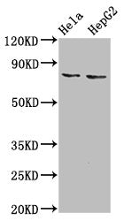 Western Blot Positive WB detected in: Hela whole cell lysate, HepG2 whole cell lysate All lanes: ESRP2 antibody at 6µg/ml Secondary Goat polyclonal to rabbit IgG at 1/50000 dilution Predicted band size: 79, 78 kDa Observed band size: 79 kDa