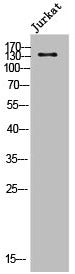 Western Blot analysis of Jurkat cells using Dsg2 Polyclonal Antibody