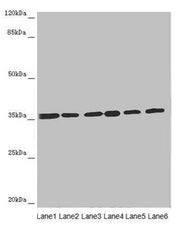 Western blot All lanes: ETFA antibody at 4.34µg/ml Lane 1: A431 whole cell lysate Lane 2: Hela whole cell lysate Lane 3: K562 whole cell lysate Lane 4: A549 whole cell lysate Lane 5: HepG2 whole cell lysate Lane 6: MCF-7 whole cell lysate Secondar...